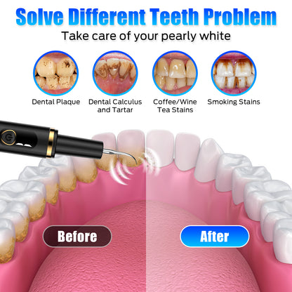 Plaque Remover for Teeth, Tartar Remover for Teeth, Dental Calculus Remover Teeth Cleaning Kit with 4 Modes and 4 Replaceable Heads